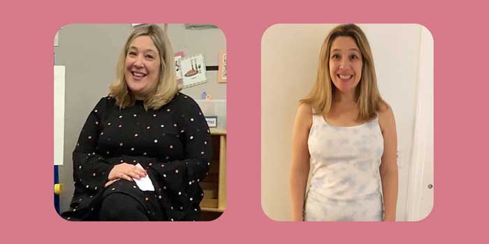 چه مواردی پس از عمل بای پس معده بهبود می‌یابد؟