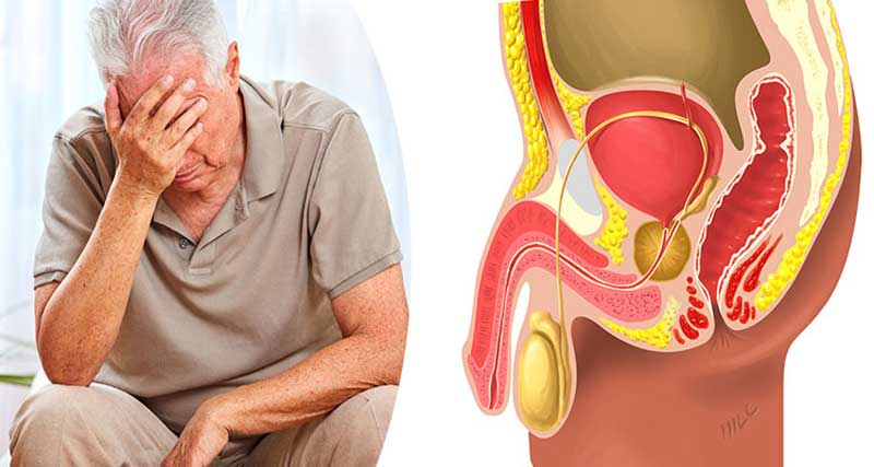 سرطان پروستات چقدر خطرناک است؟