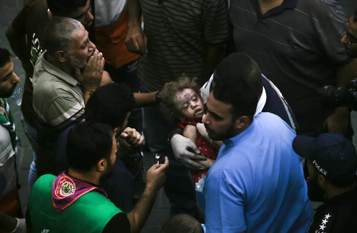 تصاویر دلخراش از حملات اسرائیل به غزه